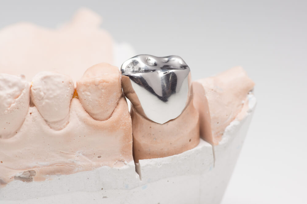 Steel artificial dental crown for dentition restoration