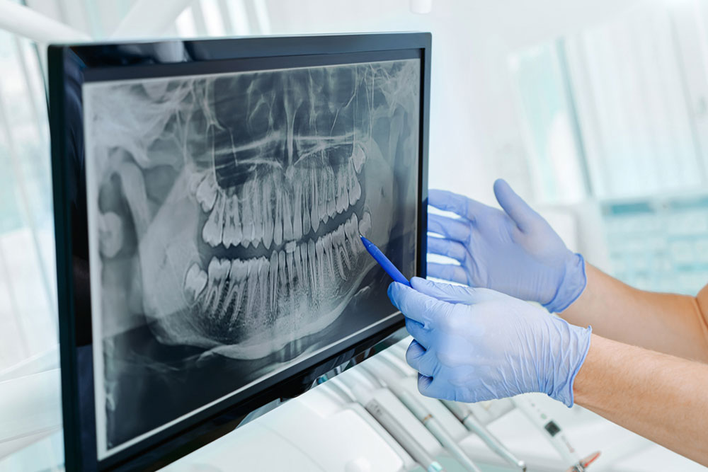 dentist showing the teeth on x-ray on digital screen