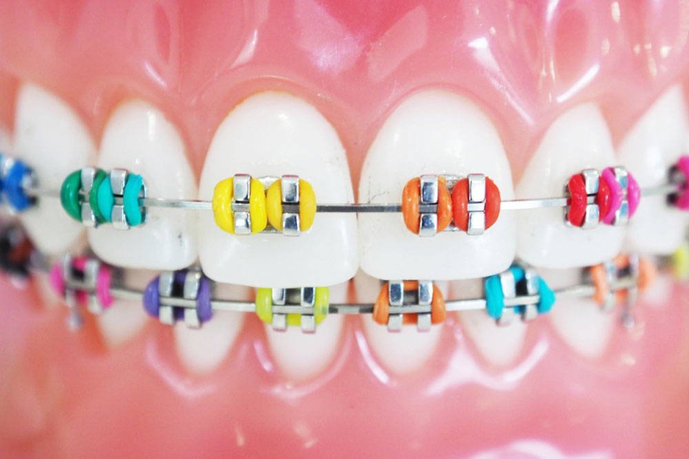 orthodontic model and dentist tool - demonstration teeth model of multi color